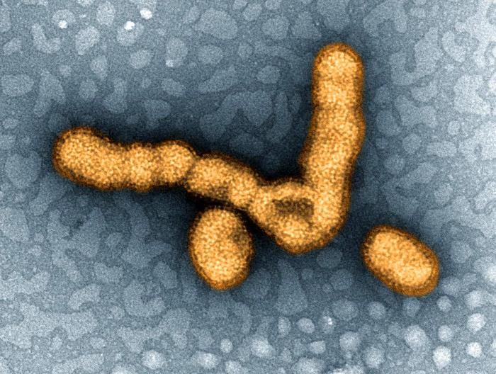 What is the name of this virus?